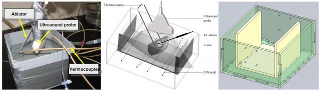 Experimental setup for US B-mode and RF data  acquisition during ablation of a tissue sample. Actual picture of a  preliminary experiment (left) and the schematic diagram of the apparatus  (right).