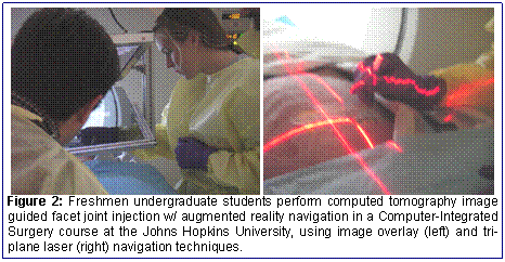 Figure 2: Freshmen undergraduate students perform computed tomography image guided facet joint injection w/ augmented reality navigation in a Computer-Integrated Surgery course at the Johns Hopkins University, using image overlay (left) and tri-plane laser (right) navigation techniques.