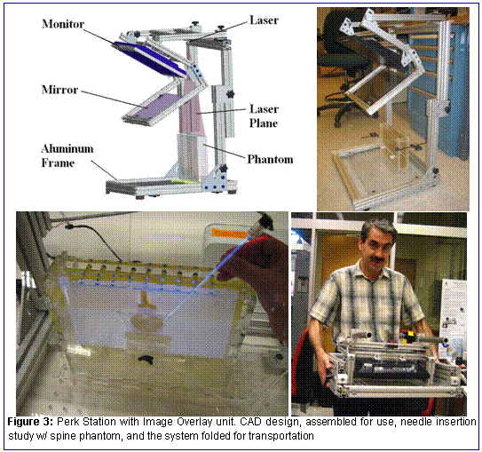 Figure 3: Perk Station with Image Overlay unit. CAD design, assembled for use, needle insertion study w/ spine phantom, and the system folded for transportation