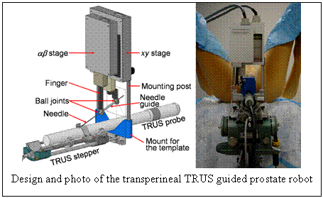 Transperineal TRUS guided prostate robot