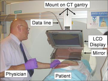 Dr. James S. Zinreich performs a needle placement with the device